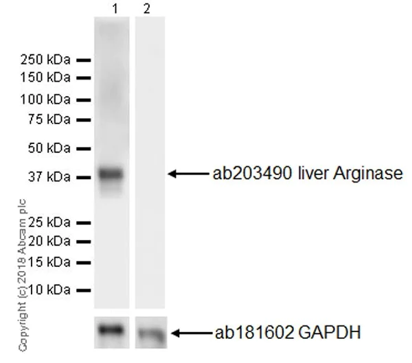 Western blot - Anti-Liver Arginase antibody [EPR19652] (AB203490)