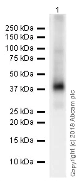 Western blot - Anti-Liver Arginase antibody [EPR19652] (AB203490)