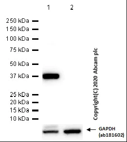 Western blot - Anti-Liver Arginase antibody [EPR19652] - BSA and Azide free (AB232932)