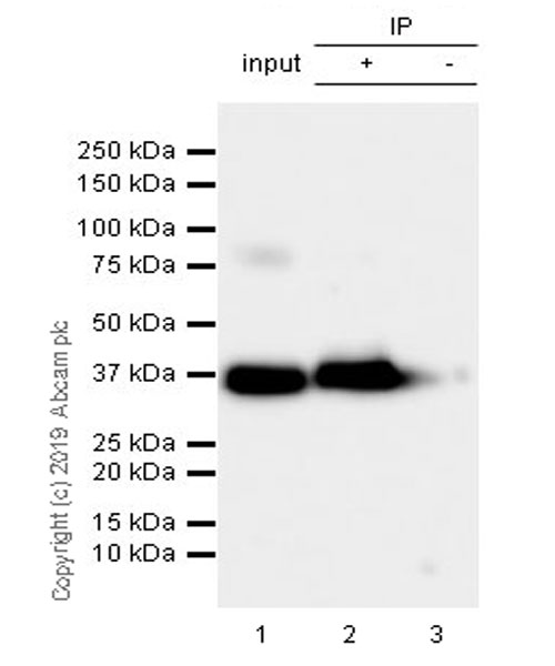 Immunoprecipitation - Anti-Liver Arginase antibody [EPR22033-369] (AB233548), expandable thumbnail