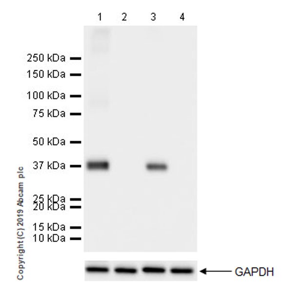 Western blot - Anti-Liver Arginase antibody [EPR22033-369] (ab233548), expandable thumbnail