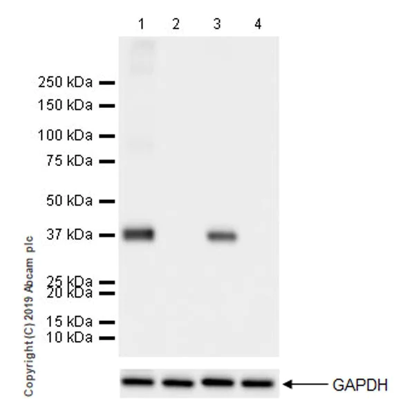 Western blot - Anti-Liver Arginase antibody [EPR22033-369] (AB233548)