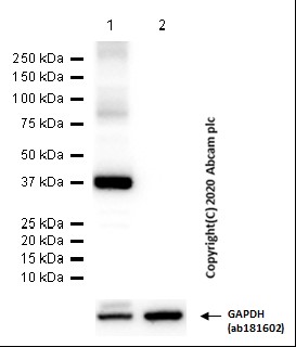 Western blot - Anti-Liver Arginase antibody [EPR22033-369] (AB233548), expandable thumbnail