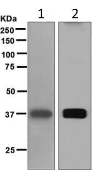 Western blot - Anti-Liver Arginase antibody [EPR6671(B)] (AB124917)