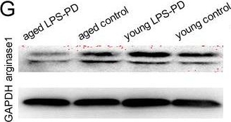 Western blot - Anti-Liver Arginase antibody [EPR6671(B)] (AB124917), expandable thumbnail