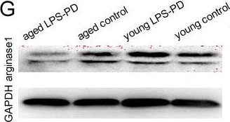Western blot - Anti-Liver Arginase antibody [EPR6671(B)] (AB124917)