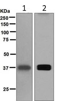 Western blot - Anti-Liver Arginase antibody [EPR6671(B)] - BSA and Azide free (AB248058), expandable thumbnail