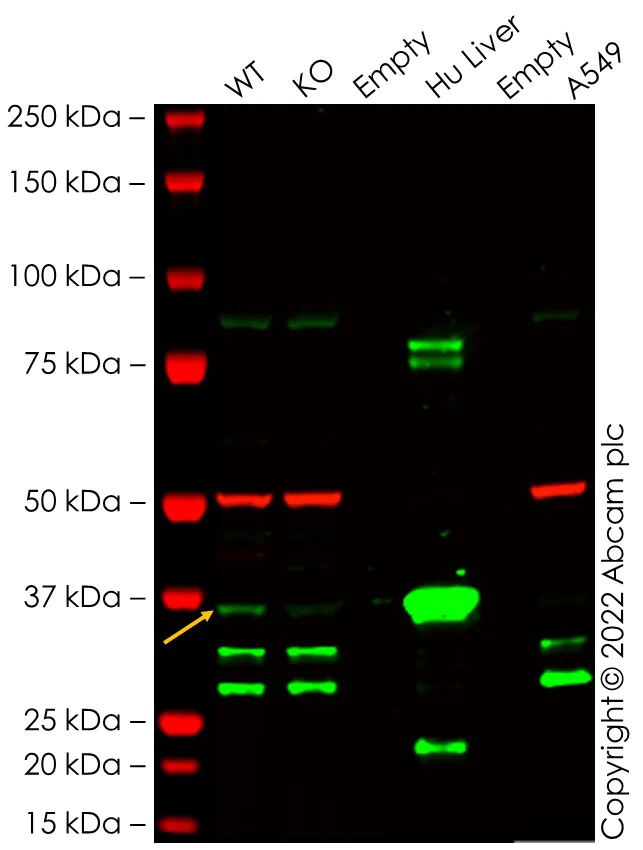 Western blot - Anti-Liver Arginase antibody [EPR6671(B)] - BSA and Azide free (AB248058)