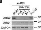 Western blot - Anti-Liver Arginase antibody [EPR6672(B)] (AB133543)