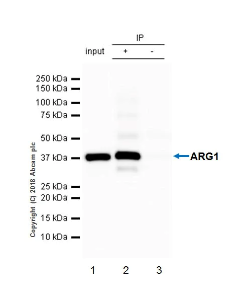 Immunoprecipitation - Anti-Liver Arginase antibody [EPR6672(B)] - BSA and Azide free (AB211961)