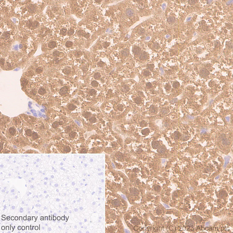 Immunohistochemistry (Formalin/PFA-fixed paraffin-embedded sections) - Anti-Liver Arginase antibody [RM1096] (AB315110)