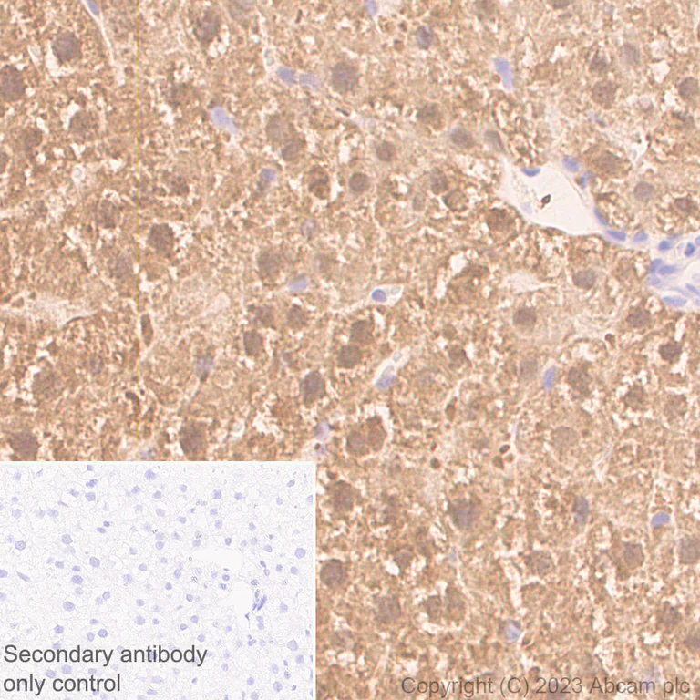 Immunohistochemistry (Formalin/PFA-fixed paraffin-embedded sections) - Anti-Liver Arginase antibody [RM1096] (AB315110)