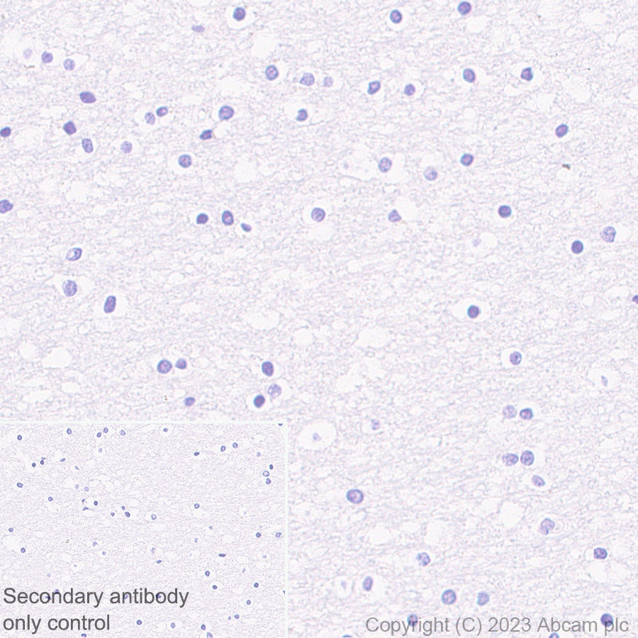 Immunohistochemistry (Formalin/PFA-fixed paraffin-embedded sections) - Anti-Liver Arginase antibody [RM1096] (AB315110), expandable thumbnail