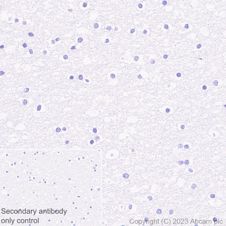 Immunohistochemistry (Formalin/PFA-fixed paraffin-embedded sections) - Anti-Liver Arginase antibody [RM1096] (AB315110)