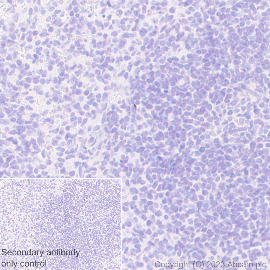Immunohistochemistry (Formalin/PFA-fixed paraffin-embedded sections) - Anti-Liver Arginase antibody [RM1096] (AB315110), expandable thumbnail