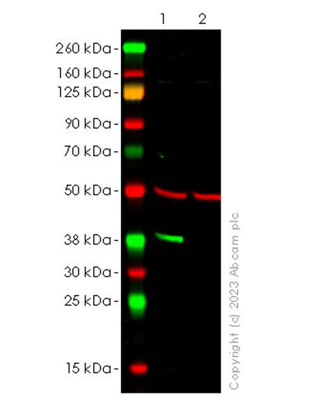Western blot - Anti-Liver Arginase antibody [RM1096] (ab315110), expandable thumbnail