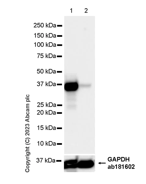 Western blot - Anti-Liver Arginase antibody [RM1096] (AB315110)