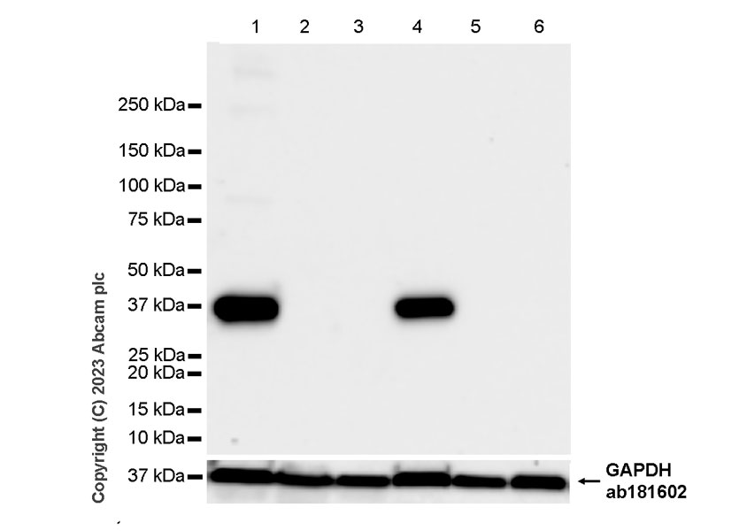 Western blot - Anti-Liver Arginase antibody [RM1096] (ab315110), expandable thumbnail