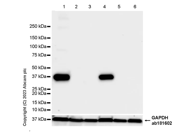 Western blot - Anti-Liver Arginase antibody [RM1096] (AB315110)
