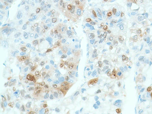 Immunohistochemistry (Formalin/PFA-fixed paraffin-embedded sections) - Anti-Liver Arginase antibody [SP156] (ab183333), expandable thumbnail