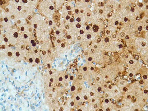Immunohistochemistry (Formalin/PFA-fixed paraffin-embedded sections) - Anti-Liver Arginase antibody [SP156] (ab183333), expandable thumbnail