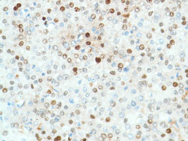 Immunohistochemistry (Formalin/PFA-fixed paraffin-embedded sections) - Anti-Liver Arginase antibody [SP156] (ab183333), expandable thumbnail