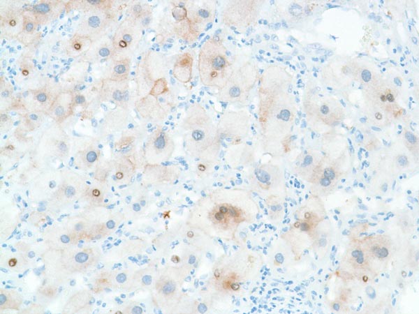 Immunohistochemistry (Formalin/PFA-fixed paraffin-embedded sections) - Anti-Liver Arginase antibody [SP156] (AB183333), expandable thumbnail
