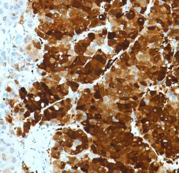 Immunohistochemistry (Formalin/PFA-fixed paraffin-embedded sections) - Anti-Liver Arginase antibody [SP156] (AB183333), expandable thumbnail