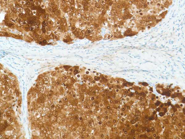 Immunohistochemistry (Formalin/PFA-fixed paraffin-embedded sections) - Anti-Liver Arginase antibody [SP156] (ab183333), expandable thumbnail
