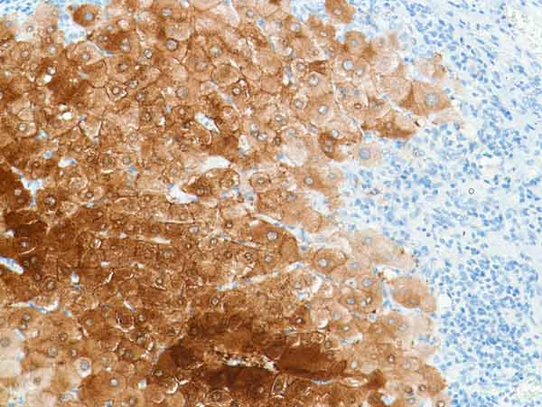 Immunohistochemistry (Formalin/PFA-fixed paraffin-embedded sections) - Anti-Liver Arginase antibody [SP156] (ab183333), expandable thumbnail