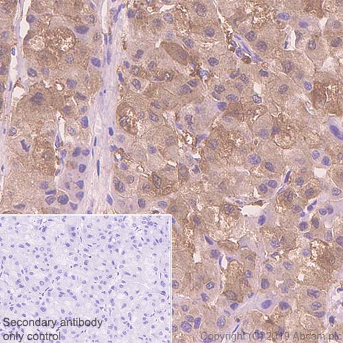 Immunohistochemistry (Formalin/PFA-fixed paraffin-embedded sections) - Anti-Liver Arginase antibody [SP156] (AB183333), expandable thumbnail