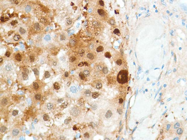 Immunohistochemistry (Formalin/PFA-fixed paraffin-embedded sections) - Anti-Liver Arginase antibody [SP156] (ab183333), expandable thumbnail