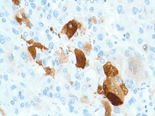 Immunohistochemistry (Formalin/PFA-fixed paraffin-embedded sections) - Anti-Liver Arginase antibody [SP156] (ab183333), expandable thumbnail