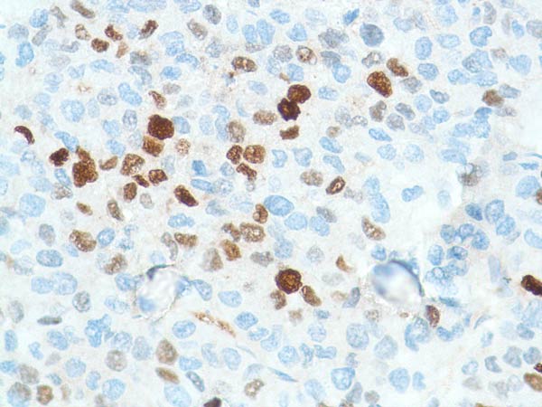 Immunohistochemistry (Formalin/PFA-fixed paraffin-embedded sections) - Anti-Liver Arginase antibody [SP156] (ab183333), expandable thumbnail