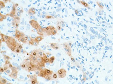 Immunohistochemistry (Formalin/PFA-fixed paraffin-embedded sections) - Anti-Liver Arginase antibody [SP156] - BSA and Azide free (AB236233)