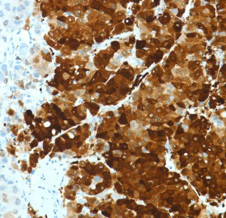 Immunohistochemistry (Formalin/PFA-fixed paraffin-embedded sections) - Anti-Liver Arginase antibody [SP156] - BSA and Azide free (AB236233)