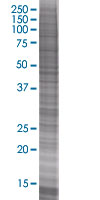 Liver Arginase overexpression 293T lysate (whole cell)
