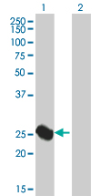 Western blot - Liver Arginase overexpression 293T lysate (whole cell) (AB94082)