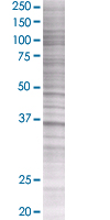Liver Arginase overexpression 293T lysate (whole cell)