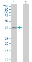 Western blot - Liver Arginase overexpression 293T lysate (whole cell) (AB94083)