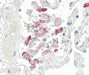 Immunohistochemistry (Formalin/PFA-fixed paraffin-embedded sections) - Anti-Liver Carboxylesterase 1/CES1 antibody (AB115280)