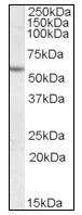 Western blot - Anti-Liver Carboxylesterase 1/CES1 antibody (AB115280)