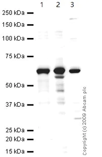 Western blot - Anti-Liver Carboxylesterase 1/CES1 antibody (AB45957)