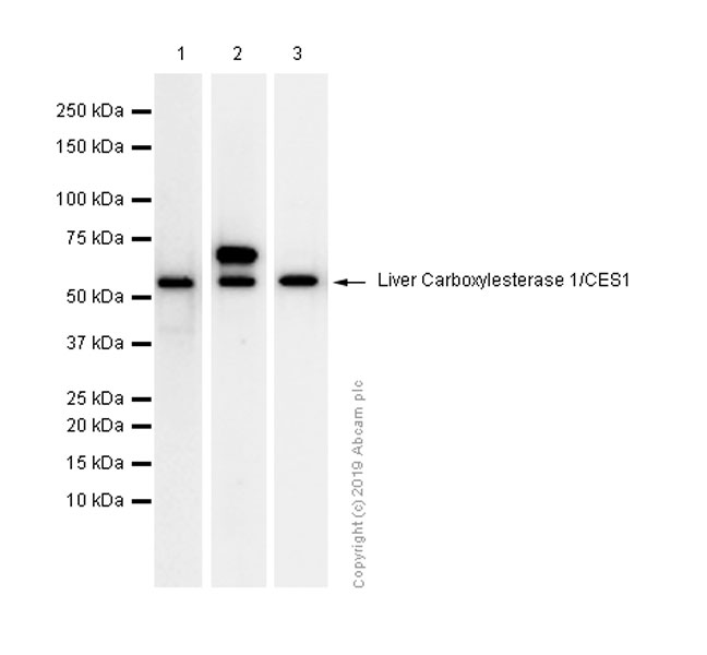 Western blot - Anti-Liver Carboxylesterase 1/CES1 antibody [EP1375Y] - BSA and Azide free (AB188033), expandable thumbnail