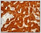 Immunohistochemistry (Formalin/PFA-fixed paraffin-embedded sections) - Anti-Liver Carboxylesterase 1/CES1 antibody [EP1376Y] (AB53008)