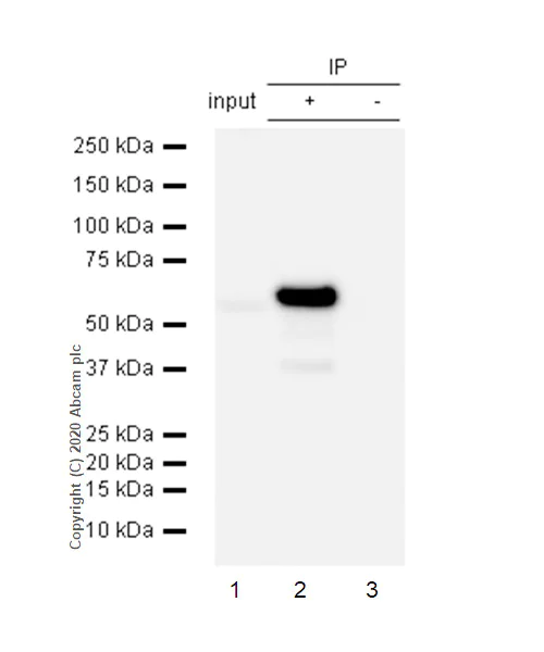Immunoprecipitation - Anti-Liver Carboxylesterase 1/CES1 antibody [EP1376Y] (AB53008)