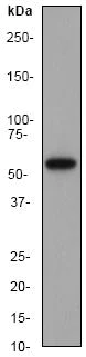Western blot - Anti-Liver Carboxylesterase 1/CES1 antibody [EP1376Y] (AB53008)