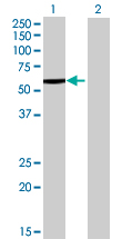 Western blot - Liver Carboxylesterase 1 overexpression 293T lysate (whole cell) (AB94047)