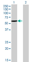 Western blot - Liver Carboxylesterase 1 overexpression 293T lysate (whole cell) (AB94047)