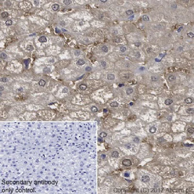 Immunohistochemistry (Formalin/PFA-fixed paraffin-embedded sections) - Anti-liver FABP antibody [EPR20464] - BSA and Azide free (AB240401)
